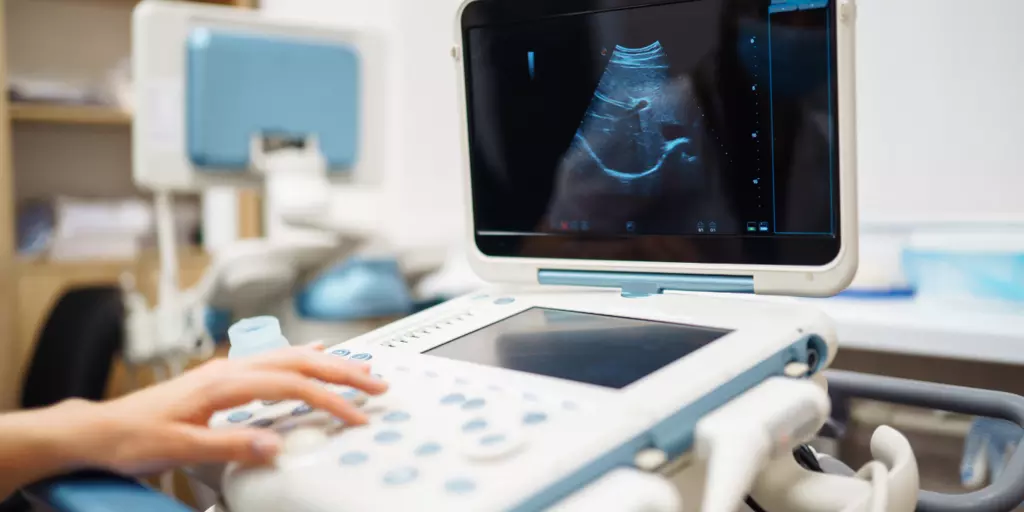 Ultrasound sono machine