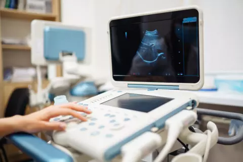 Ultrasound sono machine