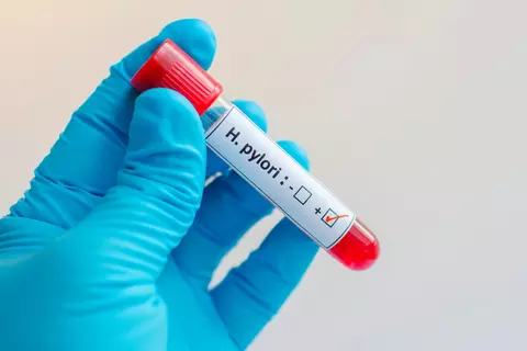 diagnostika helicobacter pylori odběr krve