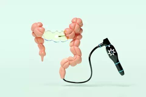 Kolonoskopie vyšetření, střevo a kolonoskop