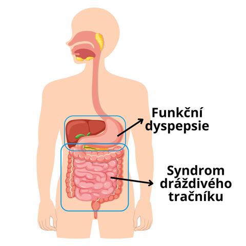 Lidský trávicí systém - rozdíl mezi funkční dyspepsií a sydromem dráždivého tračníku